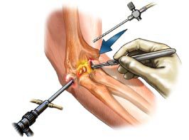 Arthroscopy Clinic