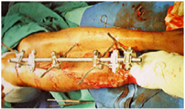 Trauma & Fracture Surgery